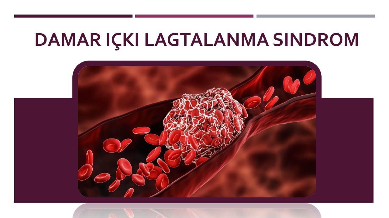 Damar i&ccedil;ki lagtalanma sindrom (DILS)